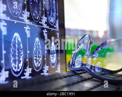 Los resultados de la exploración cerebral se reflejan en gafas protectoras que se encuentran en el teclado del portátil Foto de stock