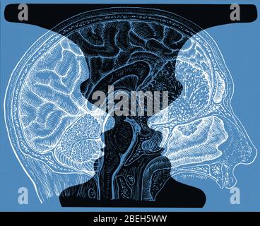 Ilustración conceptual del jarrón y cerebro Rubin Foto de stock