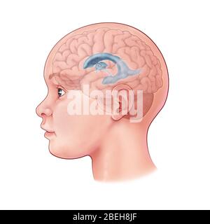 Cerebro de niños, Ilustración Foto de stock