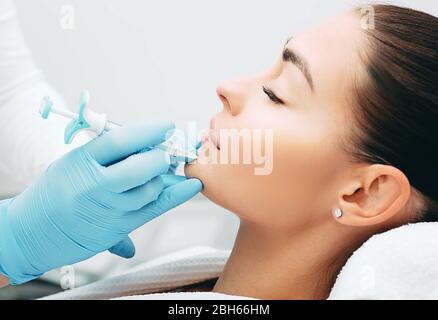 el médico con una jeringa de toxina botulínica llena una arruga cerca de la boca para rejuvenecer la piel Foto de stock