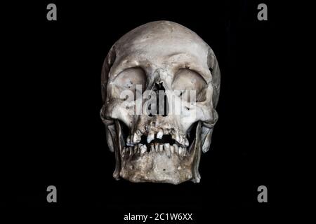 vista frontal del cráneo humano real sobre fondo negro Foto de stock