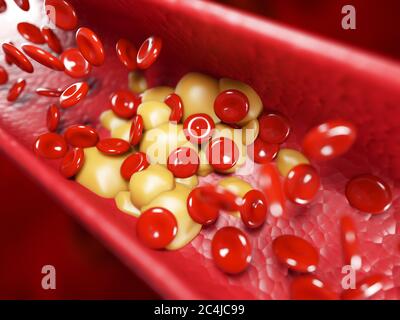 Glóbulos rojos humanos sanos y placas de colesterol. concepto de representación 3d Foto de stock