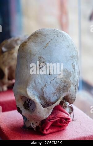 Paracas antiguo cráneo humano alargado mostrando deformación craneal debido a unión craneal, Chivay, Perú Foto de stock