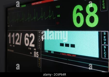 Pantalla de monitor de electrocardiograma (ECG) Foto de stock