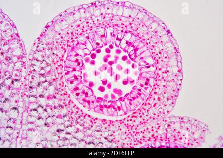 Sección transversal de la antera Lilium que muestra polen. Microscopio óptico X100.