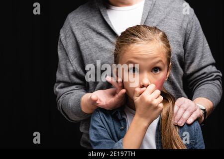 Padre abusivo abrazando y tocando la mejilla de la hija con moretones  aislado en negro Fotografía de stock - Alamy