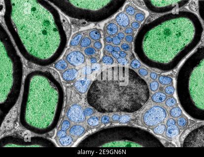 Micrografía de microscopio electrónico de transmisión de color falso (TEM) que muestra varios mielinizados Fibras (verdes) y una celda de Schwann (en el centro) que contiene Foto de stock