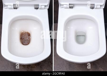 Inodoro en el cuarto de baño antes y después de limpiar el bloqueo, sucio y limpio váter Foto de stock