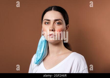 Retrato de una joven caucásica con enrojecimiento e irritación en sus mejillas por usar una máscara protectora. Fondo marrón. El concepto de rosácea Foto de stock