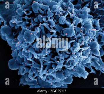 Micrografía electrónica coloreada de una célula (azul) infectada con partículas del virus SARS-CoV-2 (rosa), aislada de una muestra de paciente. Foto de stock