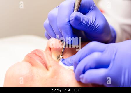 Limpieza facial profunda de la cara de una mujer con las manos y una  cuchara de un esteticista en guantes. En el salón con una toalla blanca.  Cosmetólogo usando Fotografía de stock 