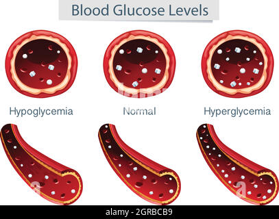 medidor de glucosa, un dispositivo para medir el azúcar en la sangre,  ilustración aislada del vector de color 6183375 Vector en Vecteezy