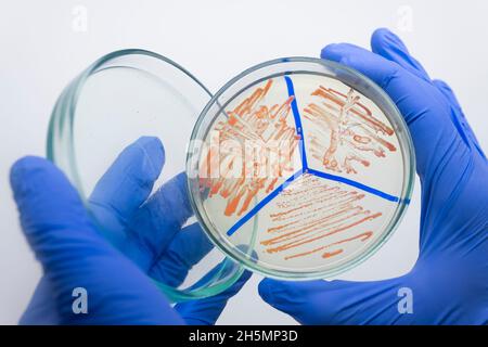 Un científico, que crece por separado las bacterias naranjas en una placa de Petri, examina las bacterias en una placa de Petri abierta en una campana de flujo laminar estéril, de cerca.