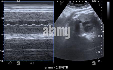 Doppler Fetal con auriculares para escuchar los latidos del corazón del bebé  en mujeres embarazadas, en primer plano, fondo de color rosa Fotografía de  stock - Alamy