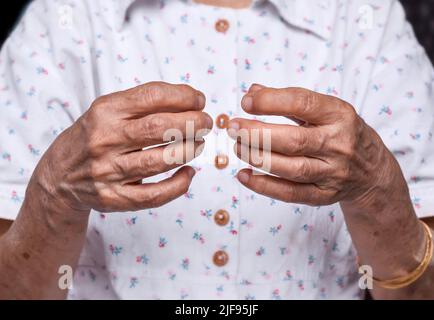 La Artrosis de manos y dedos de una mujer Fotografía de stock - Alamy