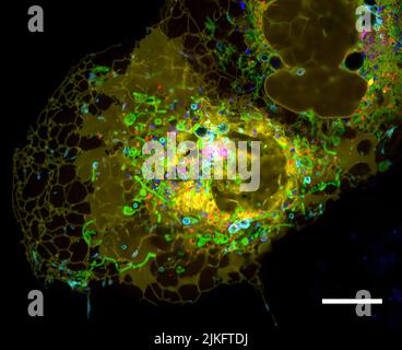 Microscopía confocal multiespectral de una célula de fibroblasto que proporciona proteínas fluorescentes dirigidas a los orgánulos: Lisosomas, mitocondrias, retículo endoplast, peroxisomas, gotitas de Golgi y lípidos. Barra de escala, 10 m. Foto de stock