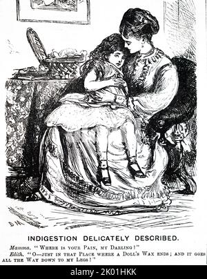 Indigestión. Dibujos animados George du Maurier de Punch, Londres, 1871. Foto de stock
