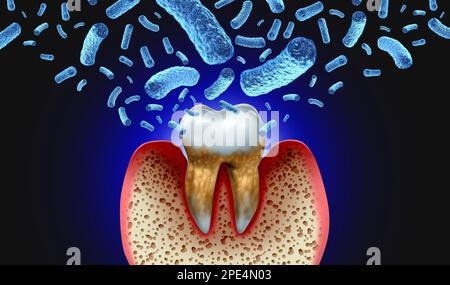 Infección dental bacteriana y enfermedad de caries dental como un molar poco saludable con periodontitis debido a la mala salud oral como una bacteria infecciosa Foto de stock