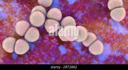 Bacteria Streptococcus pneumoniae (neumococos), ilustración por ordenador. Las bacterias esféricas grampositivas que se encuentran generalmente en pares, colonizan las vías respiratorias Foto de stock