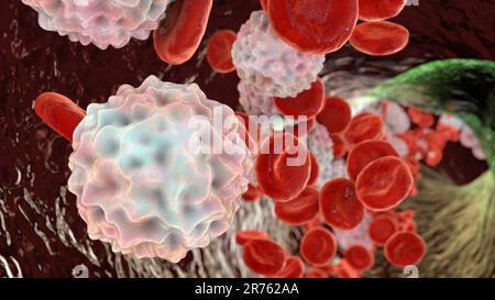 Linfocitosis, leucocitosis, ilustración de computadora que muestra abundantes glóbulos blancos dentro del vaso sanguíneo. Foto de stock