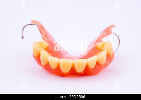 Dentadura removible de una mandíbula superior, dentadura, prótesis dental, dentista Foto de stock