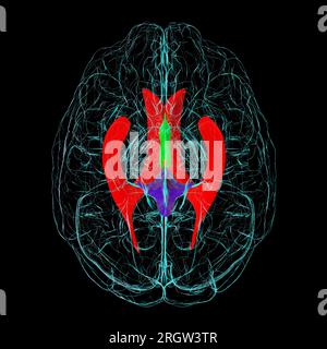 Sistema Ventricular Del Cerebro, Ilustración Fotografía De Stock - Alamy