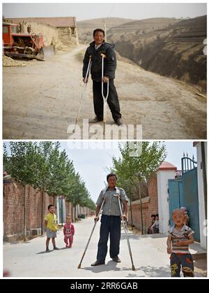 210214 -- YINCHUAN, 14 de febrero de 2021 -- ARRIBA: Zhang Junming camina en la meseta seca del municipio de Hongbaiyang, condado de Pengyang, Guyuan, región autónoma de Ningxia Hui, noroeste de China, 15 de junio de 2013 Zhang Junming da un paseo en el sitio de reubicación de Binhe Jiayuan donde su familia se mudó en Yinchuan, en el noroeste de la región autónoma de Ningxia Hui, China, 22 de junio de 2015. Zhang Junming, de 55 años, vivió una vez en el municipio de Hongbaiyang, un remanso económico en el sur de Ningxia. Cuando era joven, Zhang había sido gravemente herido en un accidente, y por lo tanto sufrió de discapacidades en las piernas que le impidieron ver Foto de stock