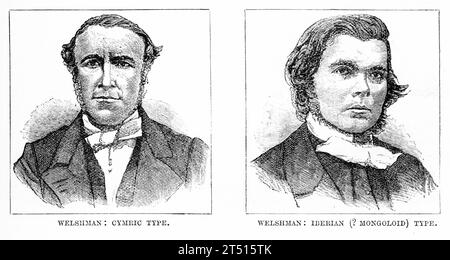 Retrato de tipos raciales entre galeses, con una comparación entre el tipo cíntrico y el tipo ibérico o mongoloide. Publicado alrededor de 1880 Foto de stock