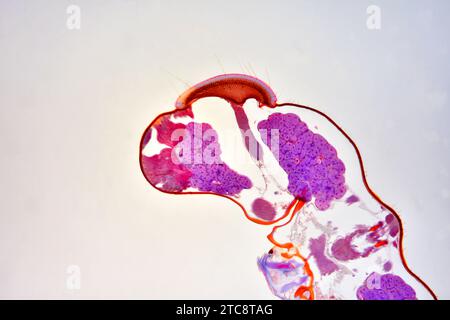 Cabeza de insecto, sección transversal que muestra cerebro, ojos compuestos, nervio óptico y cutícula. Microscopio de luz X50 a 10 cm de ancho. Foto de stock