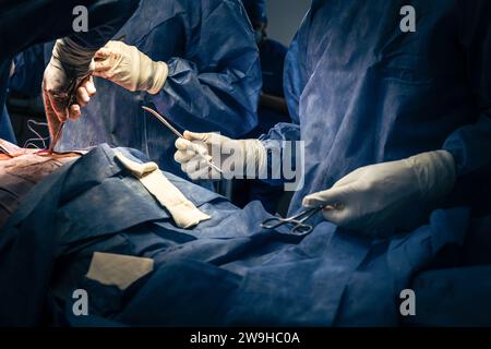 Los cirujanos y el asistente instrumental están realizando una operación quirúrgica en la sala de emergencias de un hospital. Un asistente de manos tijeras e instrumen Foto de stock