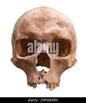 Un cráneo humano antiguo preservado para la ciencia médica, aislado sobre Un fondo blanco Foto de stock