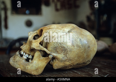 Una visión distorsionada del cráneo de un nazcan (Nazca Ica - Perú). Cráneo déformé d'un nazcan (Ica - Nazca Pérou). Foto de stock