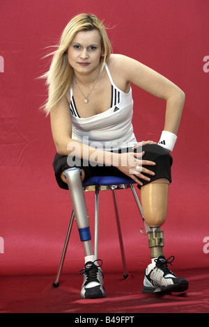 Una mujer joven con prótesis de pierna Foto de stock