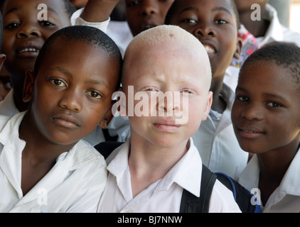 Sudáfrica - Albino muchacho negro con alumnos de un colegio de Mariannhill.  En África, la persecución de los albinos no es infrecuente Fotografía de  stock - Alamy