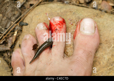 Leech tropical mordiendo el pie humano en la selva de Asia Foto de stock