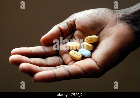 Mano con cinco tabletas de alto medido Antiretoviral ARV medicina. Ración diaria de una persona apenas enfermos de VIH para la lucha contra el SIDA Foto de stock