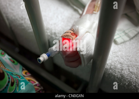 Baby Monitor cardíaco mano con equipos médicos y tubos intravenosos después de la cirugía. Foto de stock