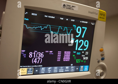 La habitación del bebé en la cama de un hospital de cuidados intensivos de cirugía cardíaca PDA equipos médicos. Monitor de ECG para la sanidad. Foto de stock