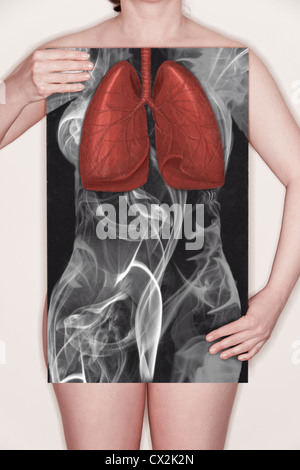 Mujer sosteniendo una pizarra con una ilustración de los pulmones dibuja un contorno de tiza y el cuerpo hecho de humo. Imagen concepto Foto de stock