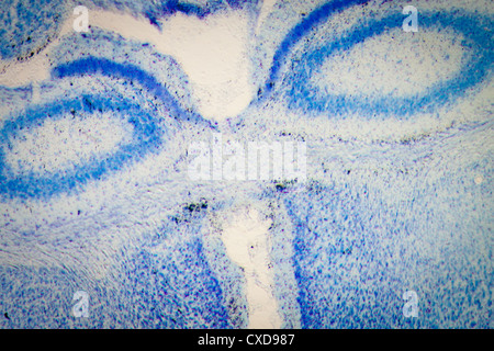 Las neuronas del hipocampo de cerebro de rata de microscopía Foto de stock