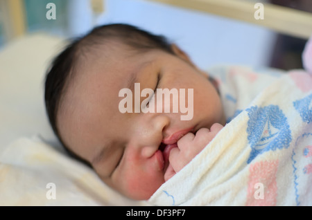 Bebé recién nacido con labio leporino y paladar hendido para dormir. Foto de stock