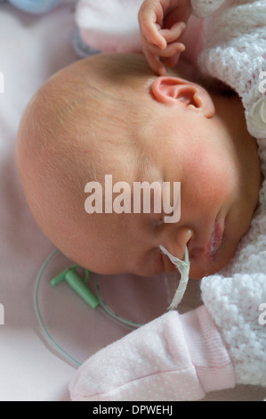 Bebés Prematuros Con Un Nasal Alimentación Tubo Y Un Chupete Foto de stock  y más banco de imágenes de Prematuro - iStock