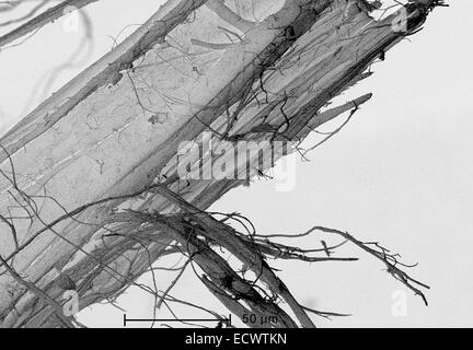 Micrografía electrónica de crisotilo amianto blanco.