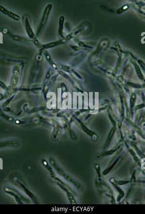 Microfotografía de Bacillus anthracis (carbunco) esporas.