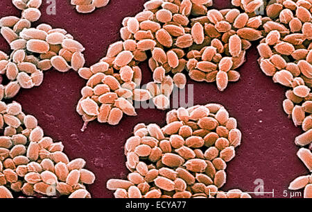 Microfotografía de Bacillus anthracis (carbunco) esporas.