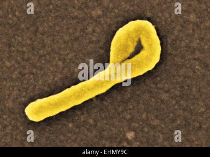 Color análisis micrografía de electrones (SEM) de una partícula de virus del ébola.