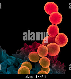 Color análisis micrografía de electrones (SEM) de una célula de sangre blanca de neutrófilos (abajo) invadiendo de Staphylococcus aureus resistente a la meticilina (MRSA bacterias, amarillo).