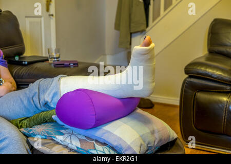 Dama con una fractura de tobillo con la pierna en una posición elevada Foto de stock