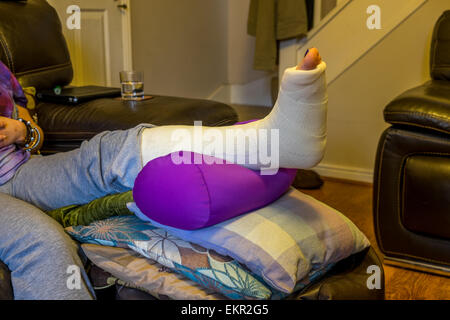 Dama con una fractura de tobillo con la pierna en una posición elevada Foto de stock