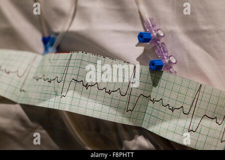 Monitor de ritmo cardíaco cinta en medical imprimir cinta - EE.UU. Foto de stock